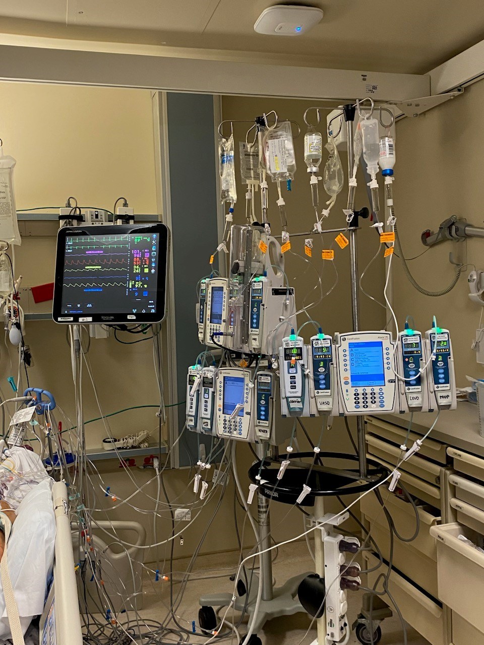 Intravenous bags and monitors were stacked up by Lanny Winters' bed while he was recovering from a devastating heart attack.