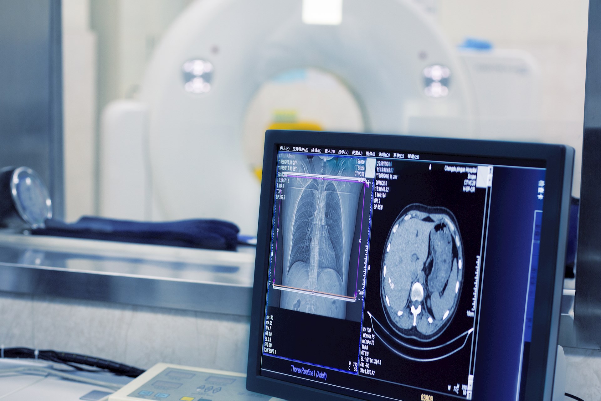 How a Contrast Media Shortage Is Affecting Medical Scans in the U.S.